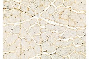 ABIN6266233 and ABIN6277387 at 1/100 staining Rat muscle tissue by IHC-P. (IGFBPI Antikörper  (C-Term))