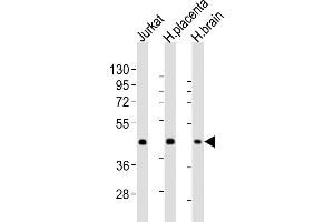 All lanes : Anti-WNT2 Antibody (Center) at 1:2000 dilution Lane 1: Jurkat whole cell lysates Lane 2: human placenta lysates Lane 3: human brain lysates Lysates/proteins at 20 μg per lane. (WNT2 Antikörper  (AA 254-287))