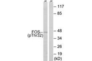 Western blot analysis of extracts from Jurkat cells treated with starved 24h, using FOS (Phospho-Ser32) Antibody. (c-FOS Antikörper  (pSer32))