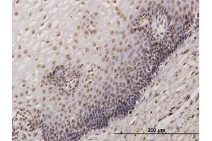 Image no. 2 for anti-KH-Type Splicing Regulatory Protein (KHSRP) (AA 151-240) antibody (ABIN599049) (KHSRP Antikörper  (AA 151-240))