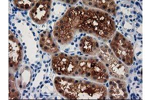 Image no. 1 for anti-Aminoacylase 3 (ACY3) antibody (ABIN1496464) (Aminoacylase 3 Antikörper)