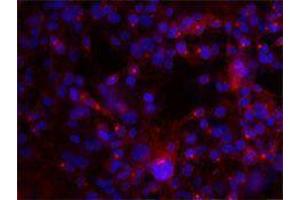 Immunofluorescence (IF) image for anti-Integrin AlphaV, Integrin Beta3 (ITGAV/ITGB3) antibody (ABIN2664760) (CD51/CD61 Antikörper)