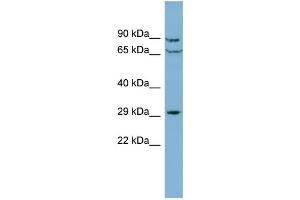 WB Suggested Anti-CUTC Antibody Titration: 0. (CUTC Antikörper  (Middle Region))