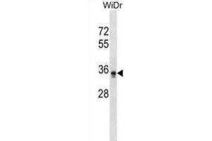 Western Blotting (WB) image for anti-Phosphatidylinositol Glycan L (PIGL) antibody (ABIN2999037) (PIGL Antikörper)