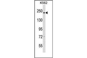 Western blot analysis of CAPD3 Antibody (C-term) in K562 cell line lysates (35ug/lane). (NCAPD3 Antikörper  (C-Term))