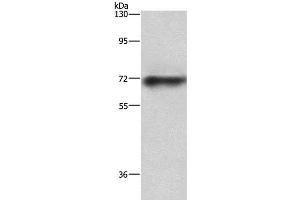 Western Blot analysis of Mouse heart tissue using ABCB8 Polyclonal Antibody at dilution of 1:750 (ABCB8 Antikörper)