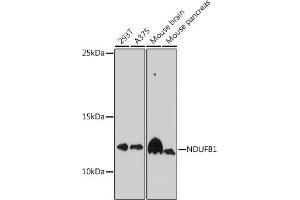 Western blot analysis of extracts of various cell lines, using NDUFB1 antibody (ABIN7268808) at 1:1000 dilution. (NDUFB1 Antikörper  (AA 1-105))