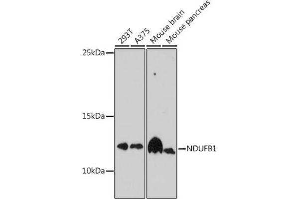 NDUFB1 抗体  (AA 1-105)