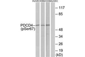 Western blot analysis of extracts from HuvEc cells, K562 cells and COS-7 cells, using PDCD4 (Phospho-Ser67) Antibody.