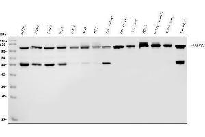 Western blot analysis of ANAPC2 using anti-ANAPC2 antibody (ABIN7601930). (ANAPC2 Antikörper  (AA 51-272))
