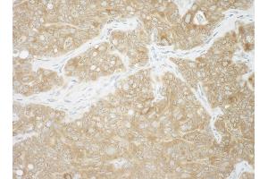 anti-Ancient Ubiquitous Protein 1 (Aup1) (AA 426-476) antibody