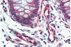 Human Colon (formalin-fixed, paraffin-embedded) stained with SERPINH1 antibody ABIN364502 at 5 ug/ml followed by biotinylated anti-mouse IgG secondary antibody ABIN481714, alkaline phosphatase-streptavidin and chromogen.
