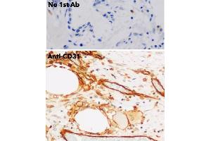 Immunohistochemistry (IHC) image for anti-Platelet/endothelial Cell Adhesion Molecule (PECAM1) (C-Term) antibody (ABIN6254202) (CD31 Antikörper  (C-Term))
