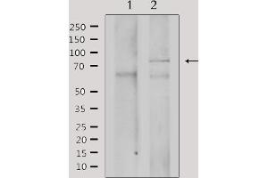 Western blot analysis of extracts from mouse brain, using GRK3 Antibody. (ADRBK2 Antikörper  (Internal Region))