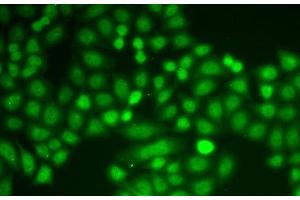 Immunofluorescence analysis of A549 cells using ASC / TMS1 Polyclonal Antibody (PYCARD Antikörper)