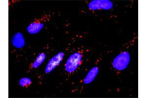 Proximity Ligation Assay (PLA) image for anti-Ezrin (EZR) (AA 1-586) antibody (ABIN521339)