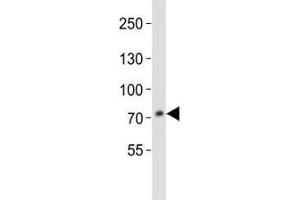 Western blot analysis of lysate from HepG2 cell line using anti-PCSK9 antibody at 1:1000.