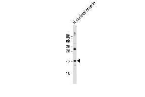 Anti-ND4L Antibody (C-term) at 1:2000 dilution + human skeletal muscle lysate Lysates/proteins at 20 μg per lane. (MT-ND4L Antikörper  (C-Term))