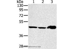 Western blot analysis of Mouse liver tissue and PC3 cell, human fetal liver tissue, using SEC14L2 Polyclonal Antibody at dilution of 1:400 (SEC14L2 Antikörper)