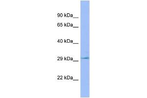 WB Suggested Anti-Lhpp Antibody Titration: 1. (LHPP Antikörper  (C-Term))