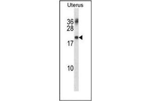 Western blot analysis of PMP22 Antibody  in Human normal Uterus cell line lysates (35ug/lane).