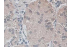 IHC-P analysis of Human Stomach Tissue, with DAB staining. (NOX5 Antikörper  (AA 456-765))