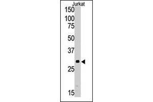 Western blot analysis of SIRT5 polyclonal antibody  in Jurkat cell lysate (35 ug/lane). (SIRT5 Antikörper  (C-Term))