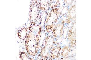 Immunohistochemistry of paraffin-embedded mouse kidney using GLUD1 Rabbit mAb (ABIN7267411) at dilution of 1:100 (40x lens).