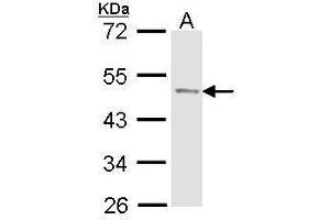 WB Image Sample (30 ug of whole cell lysate) A: Molt-4 , 10% SDS PAGE antibody diluted at 1:1000 (ACPP Antikörper)
