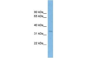 WB Suggested Anti-SSR1 Antibody Titration: 0. (SSR1 Antikörper  (Middle Region))