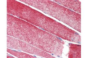 Anti-MAP3K10 / MLK2 antibody IHC staining of human skeletal muscle. (MAP3K10 Antikörper  (AA 110-138))