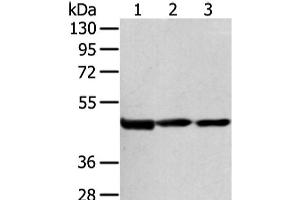 Western Blot analysis of Hela cell and Human bladder carcinoma tissue, Human normal liver tissue using AGPAT9 Polyclonal Antibody at dilution of 1/200 (AGPAT9 Antikörper)