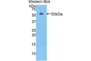 Western blot analysis of the recombinant protein. (Thymidine Phosphorylase Antikörper  (AA 33-290))