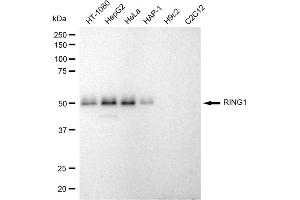 Western blotting analysis using RING1 antibody (ABIN7800240).