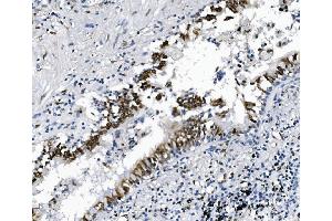IHC analysis of SAMHD1 using anti-SAMHD1 antibody (ABIN7601515).