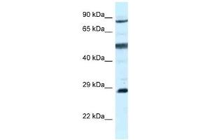Western Blot showing AK7 antibody used at a concentration of 1 ug/ml against MCF7 Cell Lysate (Adenylate Kinase 7 Antikörper  (C-Term))