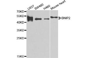 Western Blotting (WB) image for anti-BCL2/adenovirus E1B 19kDa Interacting Protein 2 (BNIP2) antibody (ABIN1980298) (BNIP2 Antikörper)