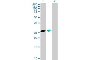 Western Blot analysis of TRIM40 expression in transfected 293T cell line by TRIM40 MaxPab polyclonal antibody. (TRIM40 Antikörper  (AA 1-258))