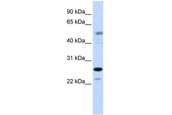 PSMC3IP Antikörper  (C-Term)