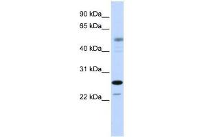 Western Blot showing PSMC3IP antibody used at a concentration of 1-2 ug/ml to detect its target protein.