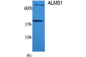Western Blotting (WB) image for anti-Alstrom Syndrome 1 (ALMS1) (Internal Region) antibody (ABIN3173760) (ALMS1 Antikörper  (Internal Region))