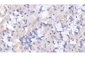 Immunohistochemistry (IHC) image for anti-BCL2-Like 2 (BCL2L2) (AA 2-193) antibody (ABIN7438820)