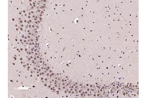 Paraformaldehyde-fixed, paraffin embedded mouse brain Antigen retrieval by boiling in sodium citrate buffer (pH6.