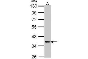 WB Image Sample (30 ug of whole cell lysate) A: A431 , 10% SDS PAGE antibody diluted at 1:1000 (PRKX Antikörper)