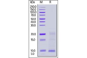 SDS-PAGE (SDS) image for Thymic Stromal Lymphopoietin (TSLP) (AA 29-159) (Active) protein (His tag) (ABIN7013407)