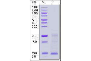 Cynomolgus TSLP, His Tag on  under reducing (R) condition. (Thymic Stromal Lymphopoietin Protein (TSLP) (AA 29-159) (His tag))