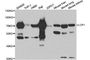 Western Blotting (WB) image for anti-Lymphocyte Cytosolic Protein 1 (LCP1) antibody (ABIN1876741) (LCP1 Antikörper)