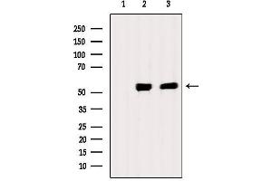 Western blot analysis of extracts from various samples, using Chk1 Antibody.
