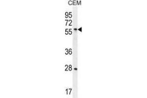 Western blot analysis in CEM cell line lysates (35ug/lane) using DLK1  Antibody .