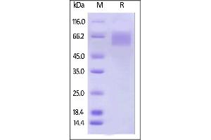 SDS-PAGE (SDS) image for Interleukin 17 Receptor A (IL17RA) (AA 33-320) (Active) protein (His tag,AVI tag,Biotin) (ABIN5674597)
